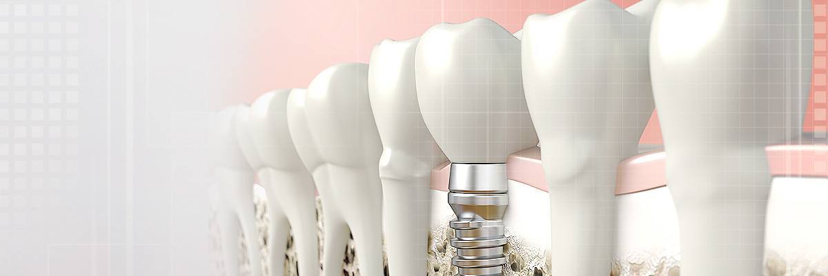 Campbell Dental Prosthetics