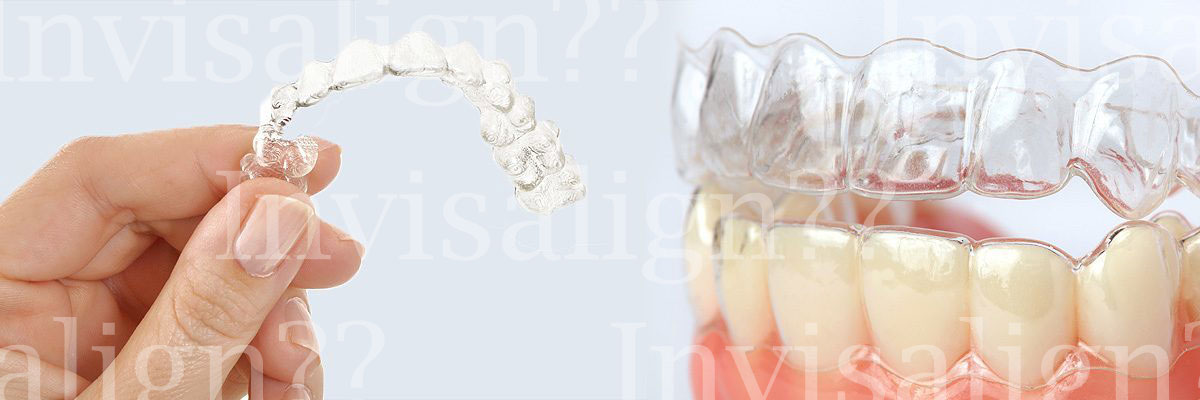 Campbell Does Invisalign® Really Work?