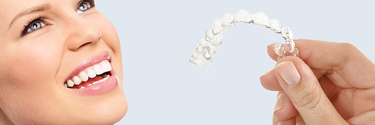 Campbell 7 Things Parents Need to Know About Invisalign Teen