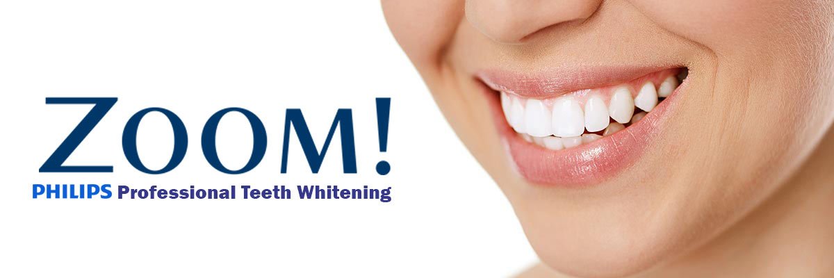 Campbell Zoom Teeth Whitening